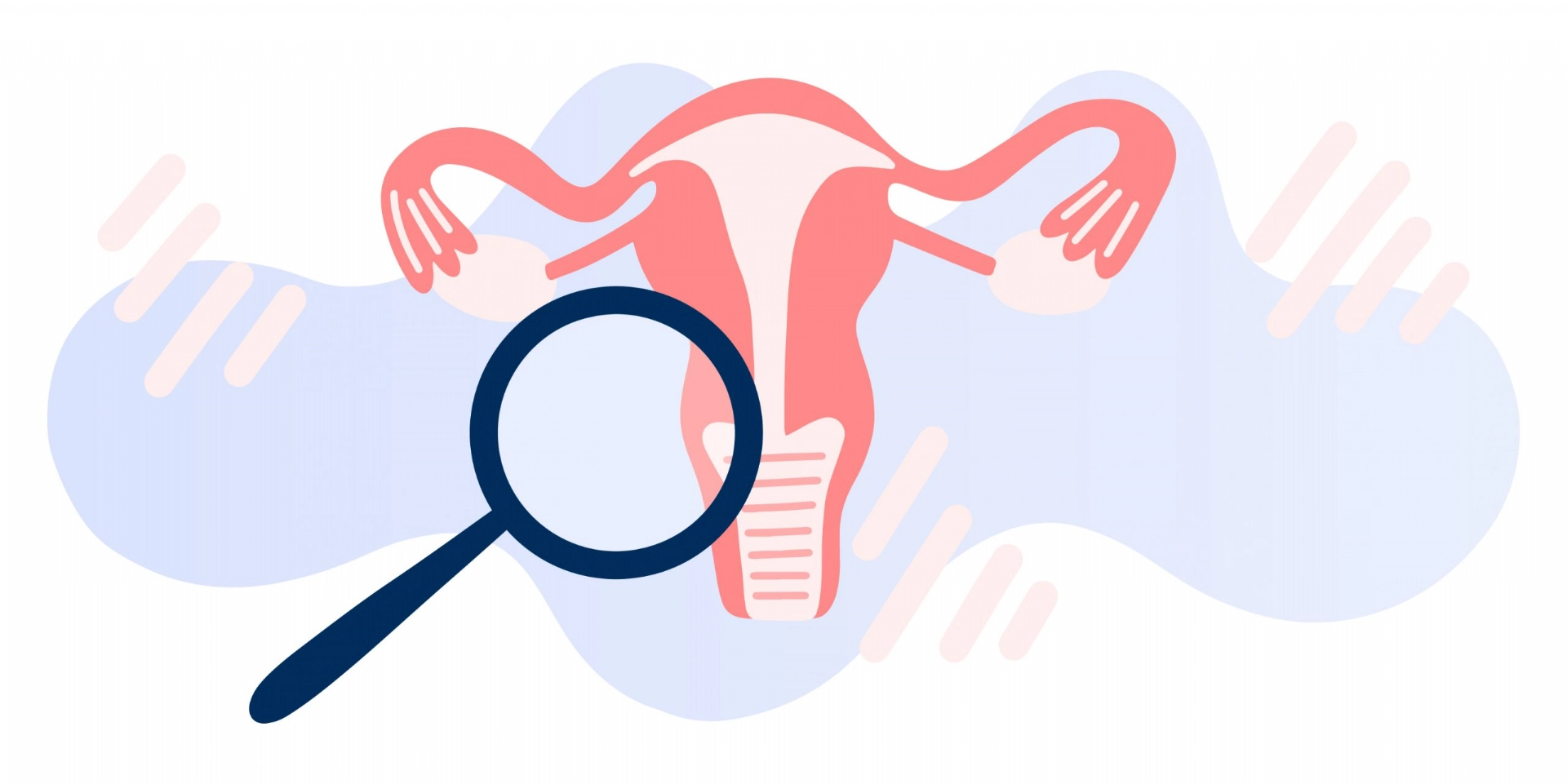 Gynecological Problems