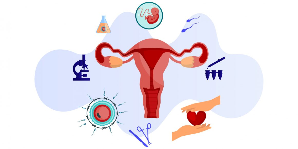 In Vitro Fertilization (IVF)