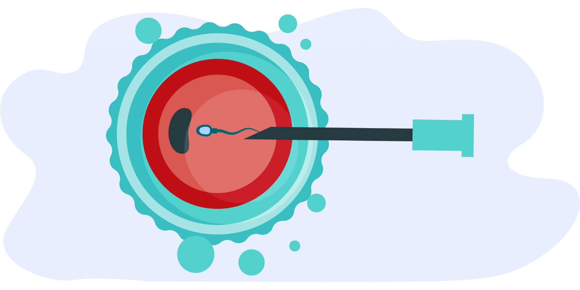 Microinjection (ICSI)